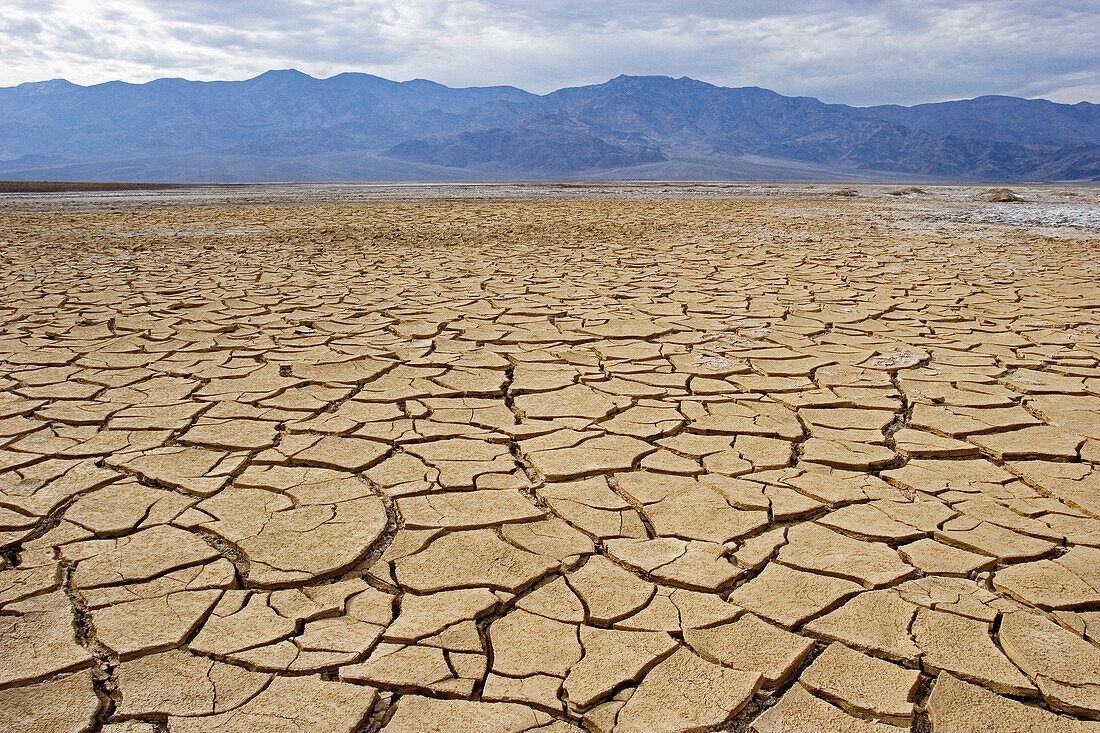  Sécheresse oculaire (Dry Eye)