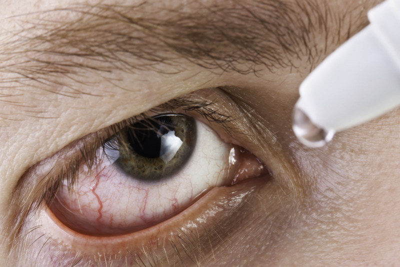 Allergie oculaire : causes, symptômes, traitement et prévention Cabinet Dr Jihane Ait Elhaj – Casablanca