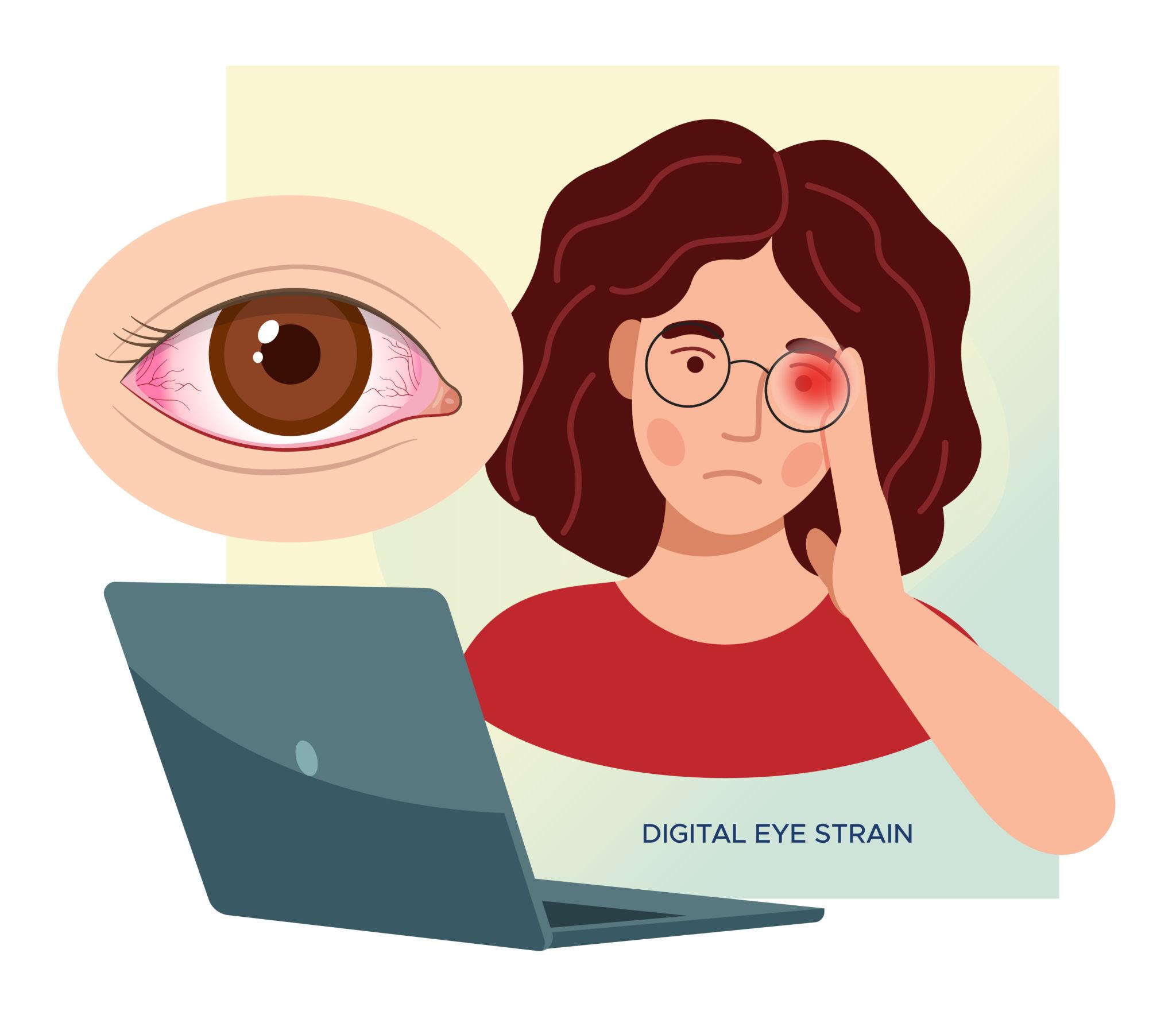 Fatigue oculaire (Asthénopie) : causes, symptômes et solutions